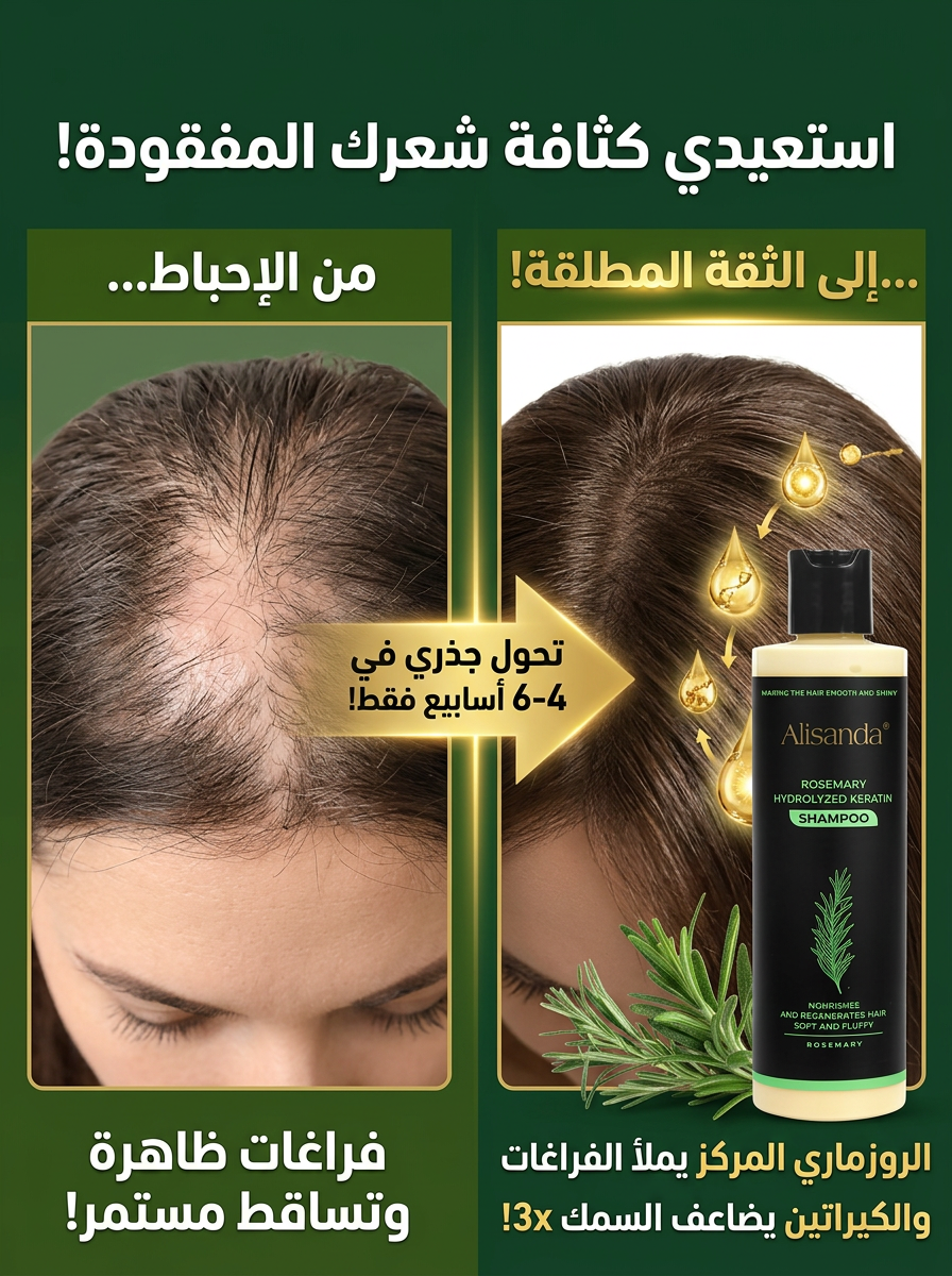 – شامبو أليساندا (Alisanda) بالروزماري والكيراتين