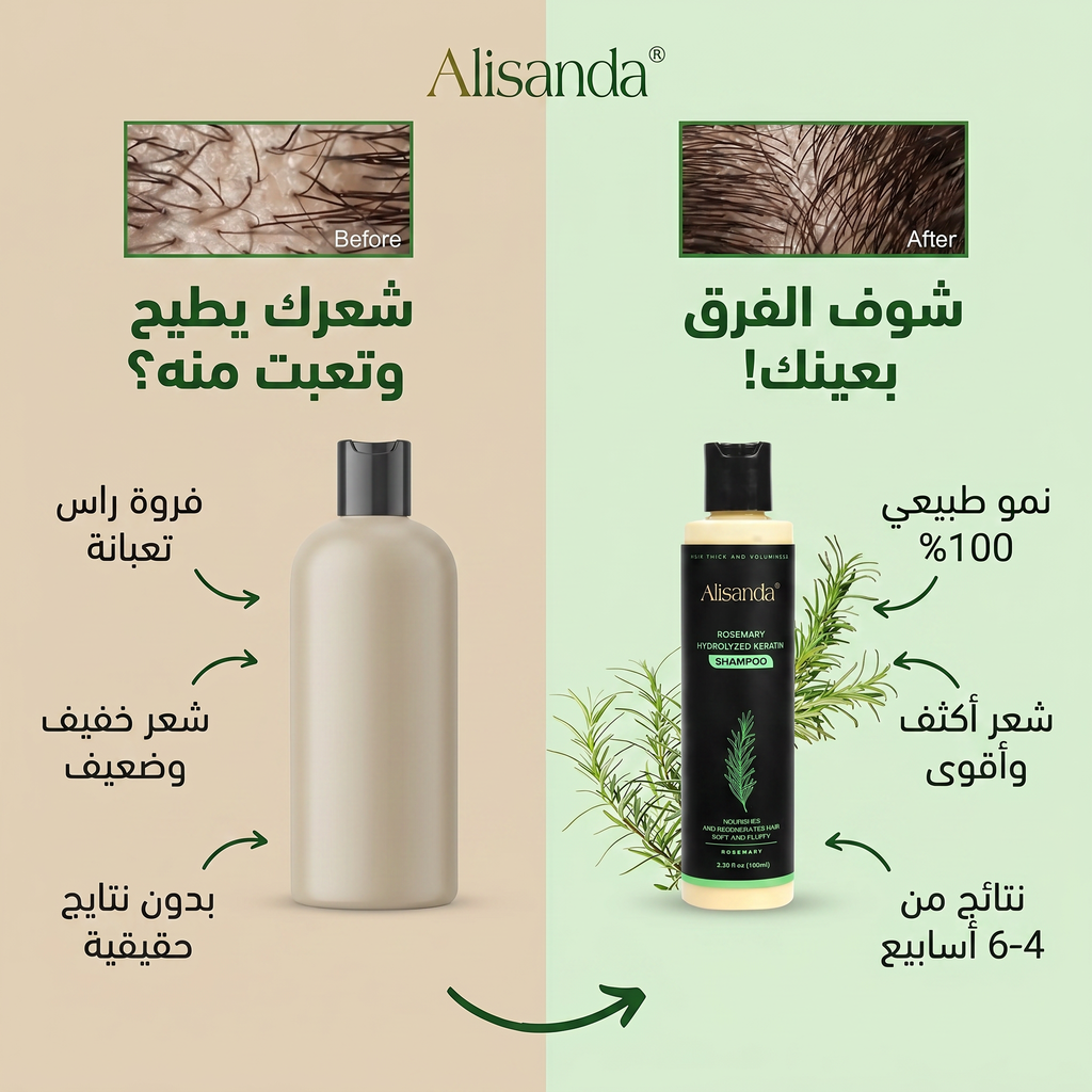 – شامبو أليساندا (Alisanda) بالروزماري والكيراتين