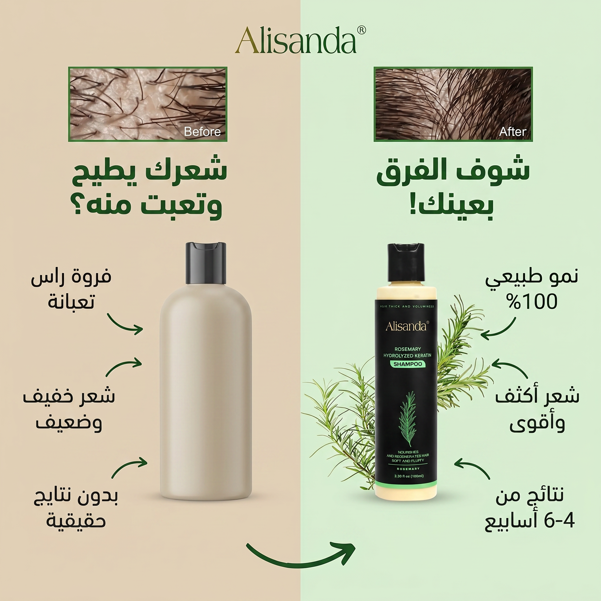 – شامبو أليساندا (Alisanda) بالروزماري والكيراتين