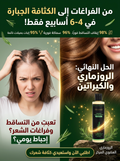 – شامبو أليساندا (Alisanda) بالروزماري والكيراتين